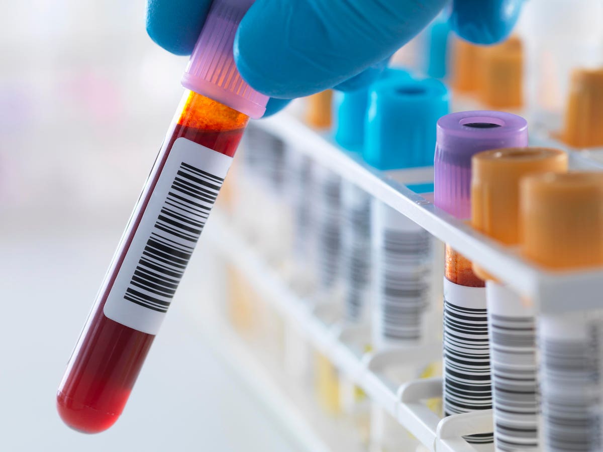Blood Test Could Detect Cancer Up To Seven Years Earlier