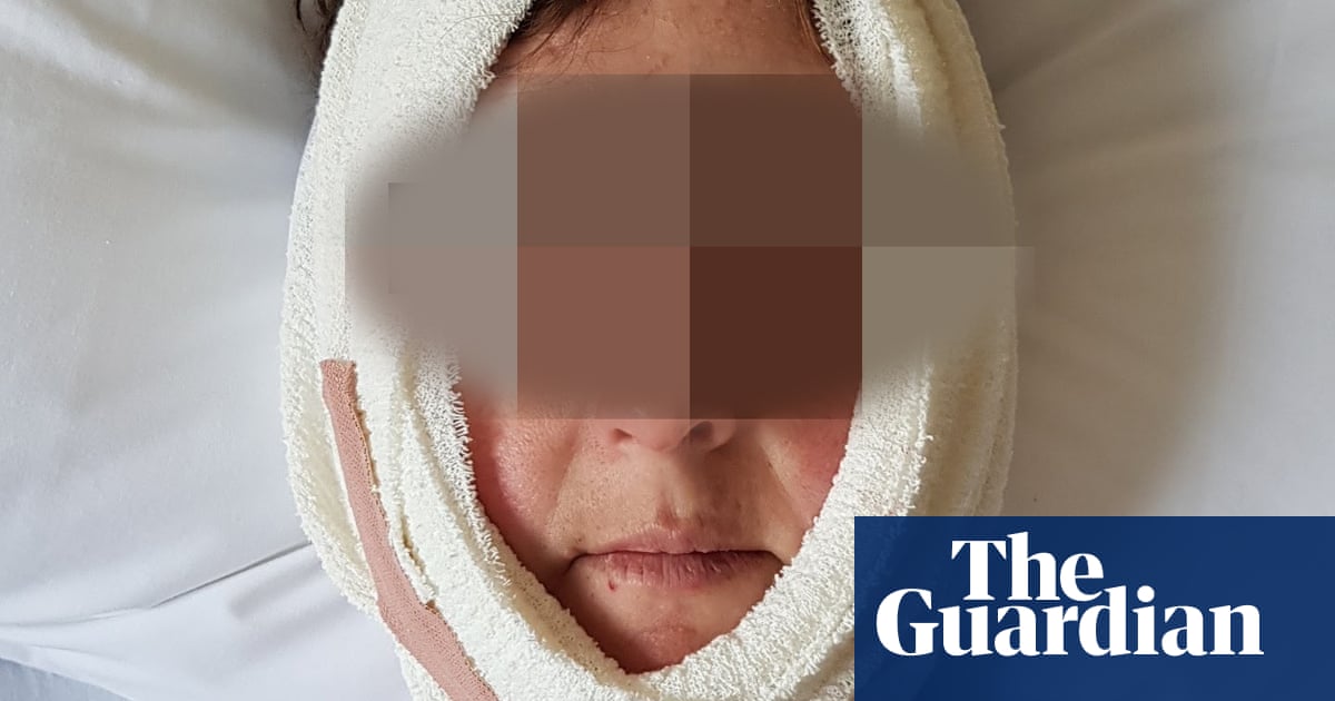 Melbourne jaw surgeon may face legal action from second patient alleging negligence | Health