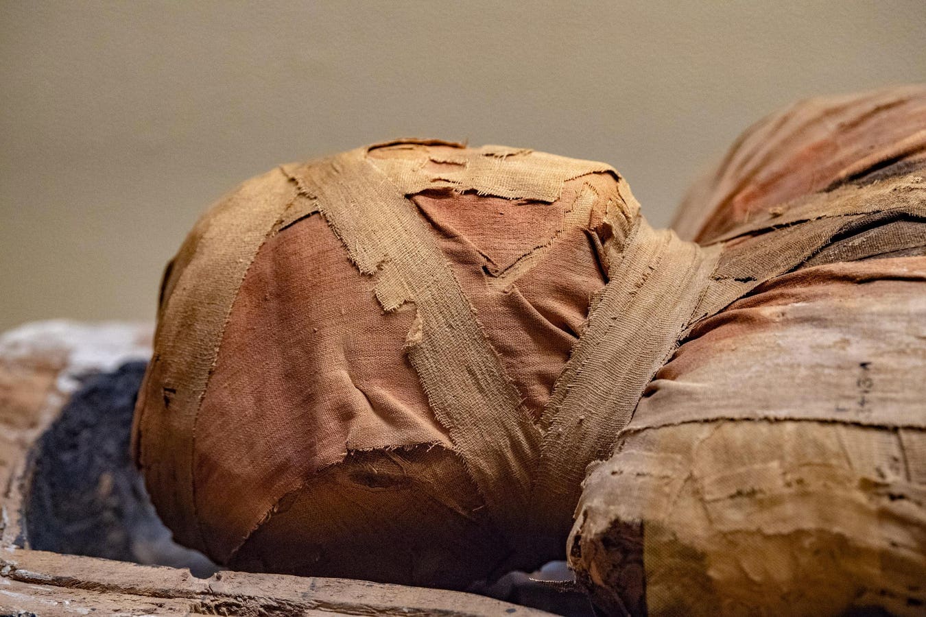 Over 4000-Year-Old Mummies Had Atherosclerotic Heart Disease