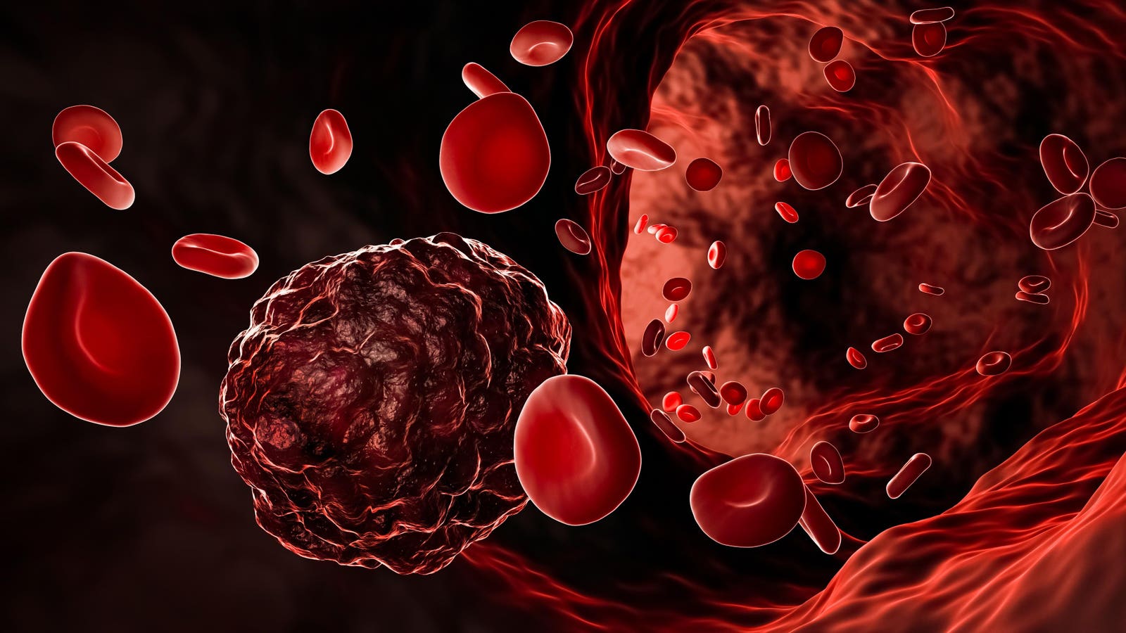 The Push For A Universal Blood Cancer Therapy