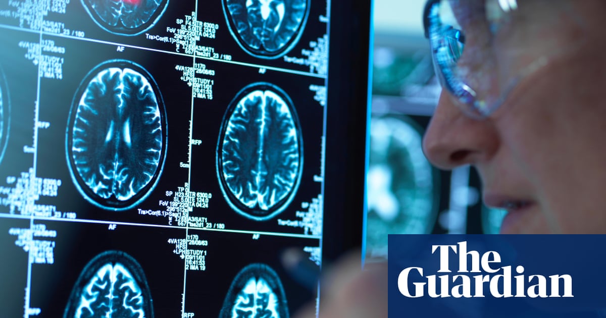 Record numbers of people in England given dementia diagnosis in past year | Dementia