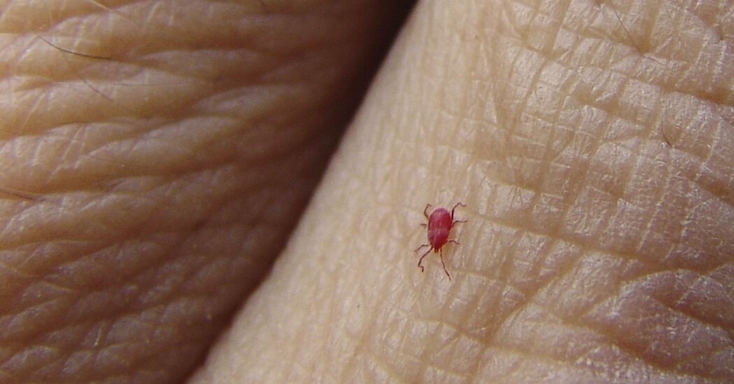 What to Know About Chiggers Bites, Symptoms and Treatment