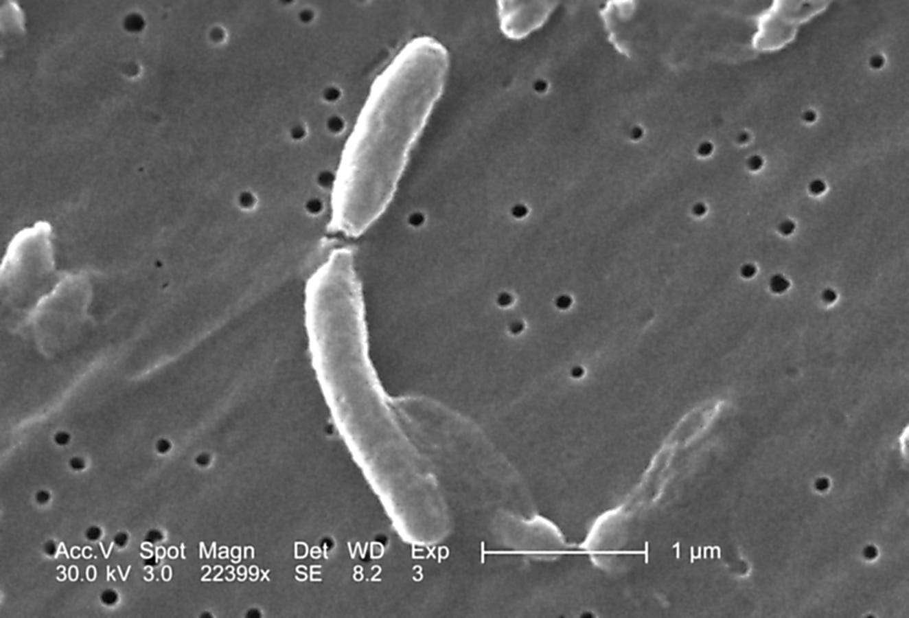 Climate Change Could Trigger The Spread Of Novel Cholera Strains