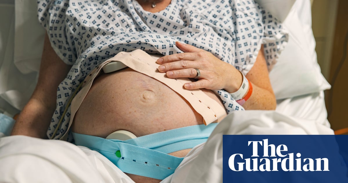 Not expecting: pregnancy after getting ‘tubes tied’ is surprisingly common | US news