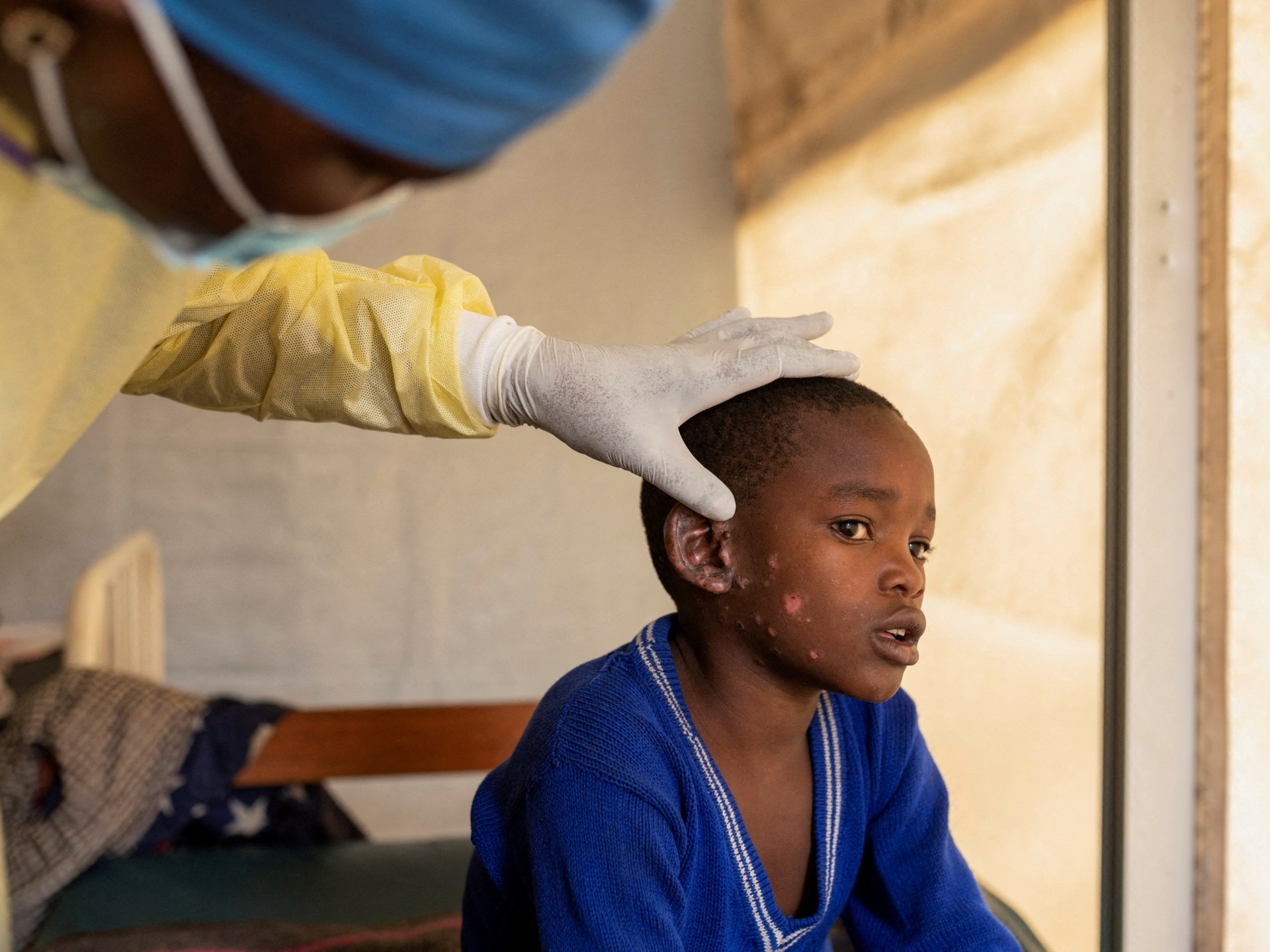 Sweden confirms first case of mpox strain outside Africa | Health News