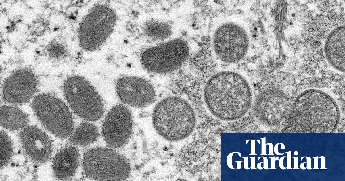 Mpox outbreak puts Africa on brink of official public health emergency | Africa