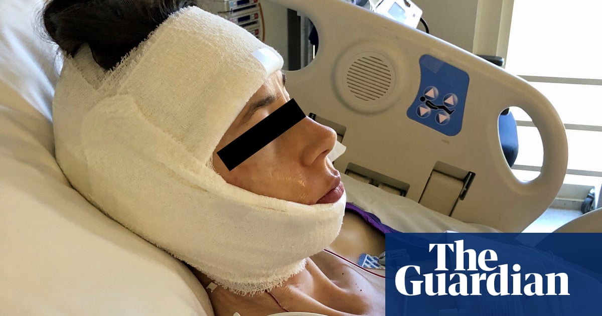 Melbourne surgeon failed to tell patient he invented ‘experimental’ device used to replace jaw joints, court documents claim | Victoria