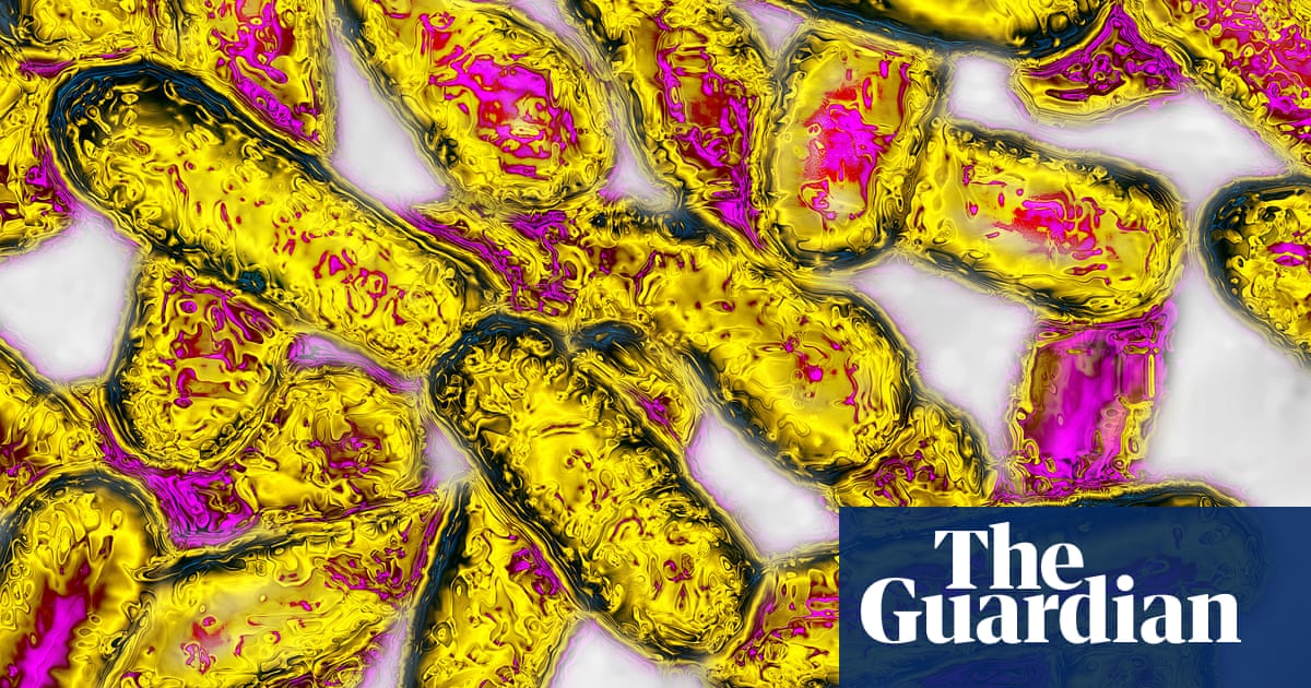 Second person dies after being diagnosed with legionnaires’ disease amid Melbourne outbreak | Victoria