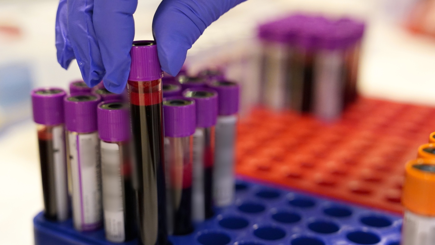 New blood tests can help diagnose Alzheimer's. Doctors are still catching up : Shots