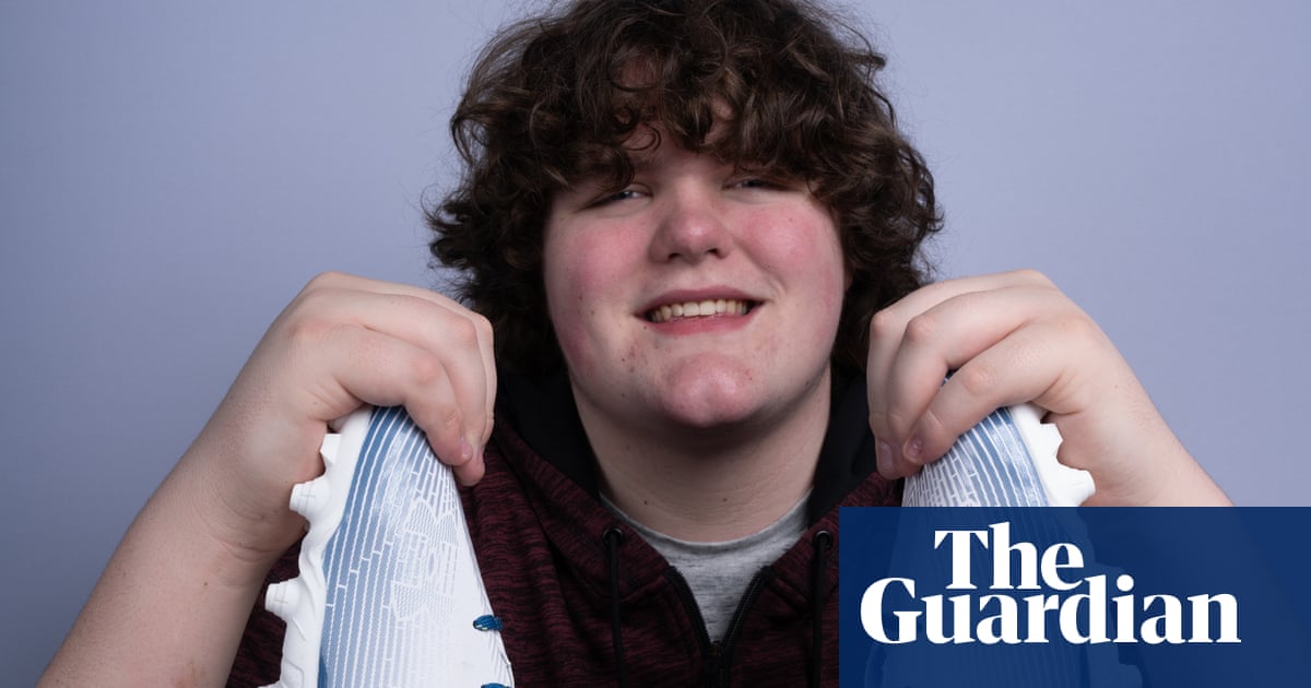 ‘It is OK to stand out’: US teen’s hands and feet are world record-setting | US news