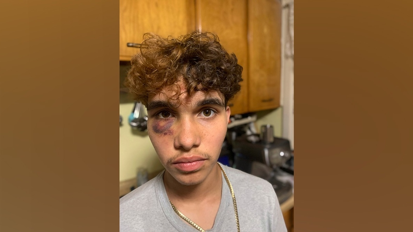 Attack on trans teen being investigated as 'possible hate crime'