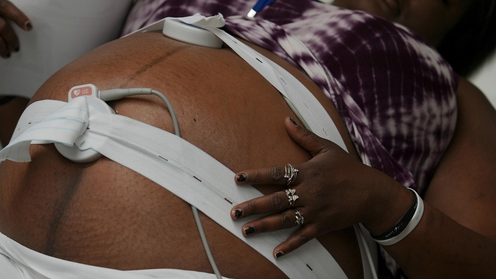 America is trying to fix its maternal mortality crisis with federal, state and local programs