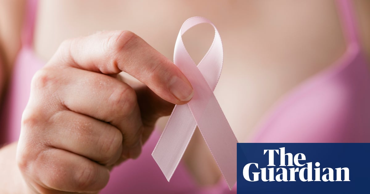 US breast cancer deaths fall but younger women increasingly diagnosed – study | US healthcare