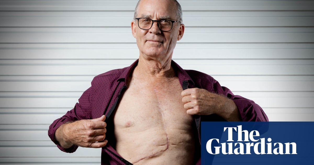 ‘I couldn’t believe it’: routine GP checkup reveals 2kg tumour growing in Brisbane man’s liver | Health