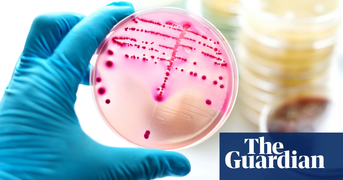 Australian women to get self tests for chlamydia and gonorrhoea – but experts urge caution | Sexual health