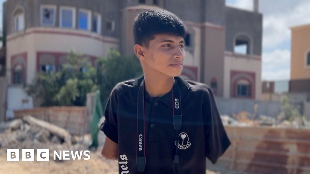 Gaza's amputees offered easy-to-fit prosthetics using UK technology